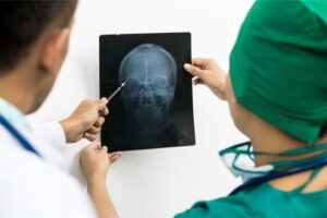 Houston Brain Injury Lawyer - Payne Law Firm